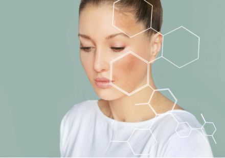 How To Repair Damaged Skin Barrier 7-Day Skin Reset