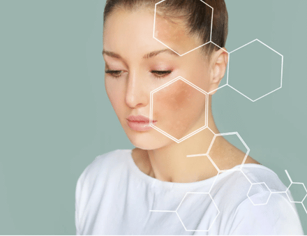 How To Repair Damaged Skin Barrier 7-Day Skin Reset