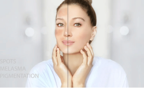 How to Repair Damaged Skin Barrier Without Overdoing It
