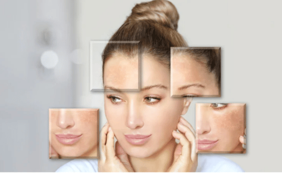 What a Damaged Skin Barrier Actually Feels Like