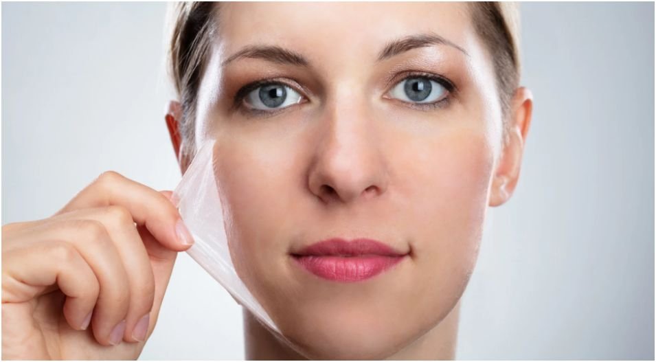 chemical exfoliation for acne prone skin