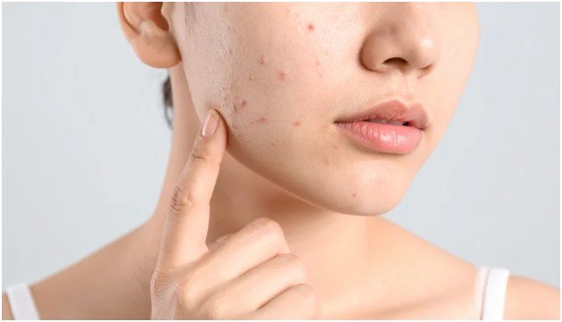 What Not to Mix on Exfoliation Night