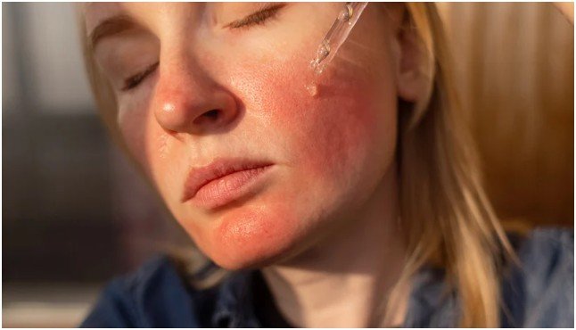 lactic Acid vs Glycolic Acid: Which One Feels Gentler?