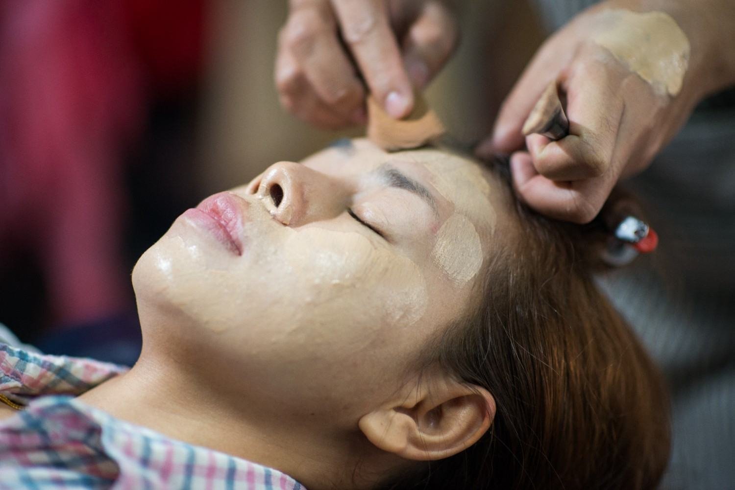 Should you clear active acne before scar treatment?