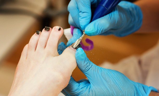 A Gentle Routine for Removing Regular Polish