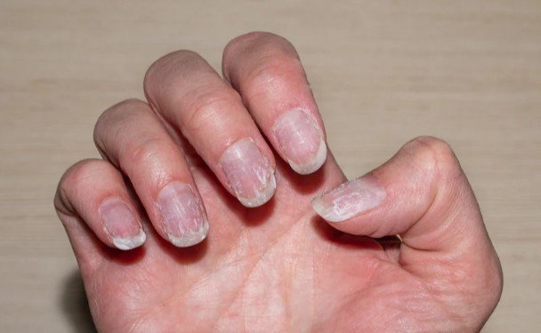Five Gentle Steps for Post-Gel Aftercare