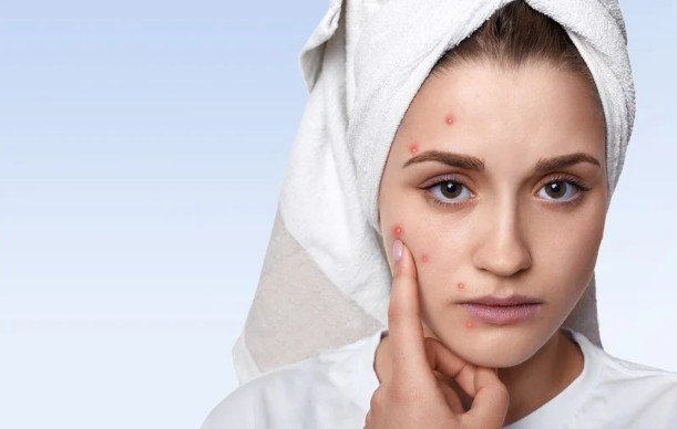 What Causes Pimples After a Facial